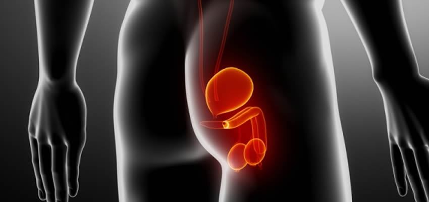 La nocturia, una consecuencia de la hiperplasia benigna de próstata